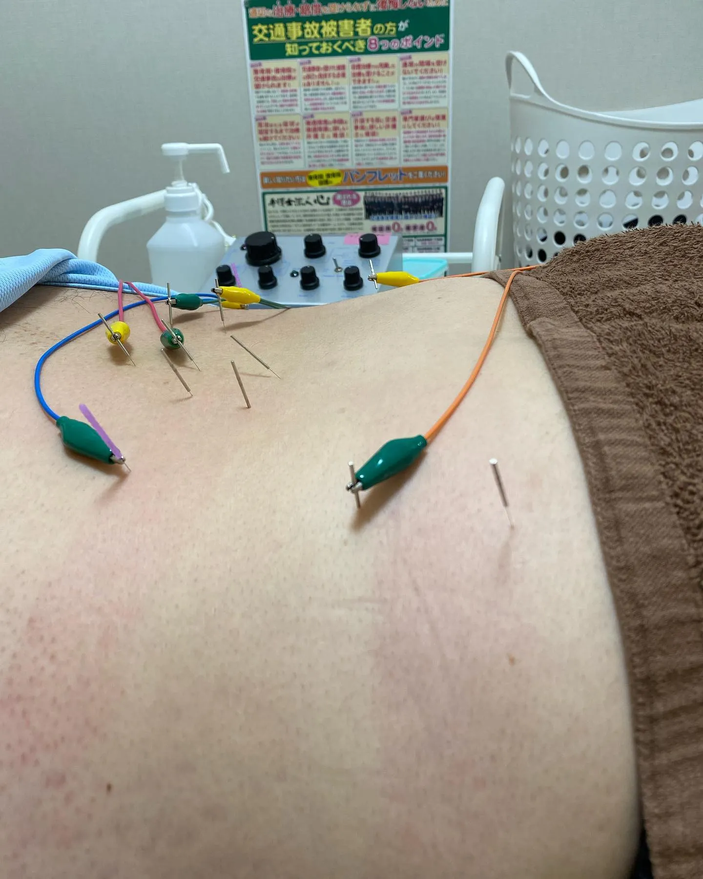 名古屋で深層筋アプローチできる鍼灸接骨院です！