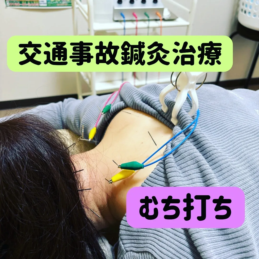 名古屋で交通事故による『むち打ち』にもオススメの接骨院です！