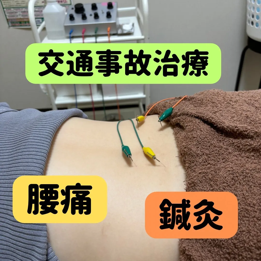 交通事故接骨院を名古屋西区でお探しならいろは鍼灸接骨院へ！！