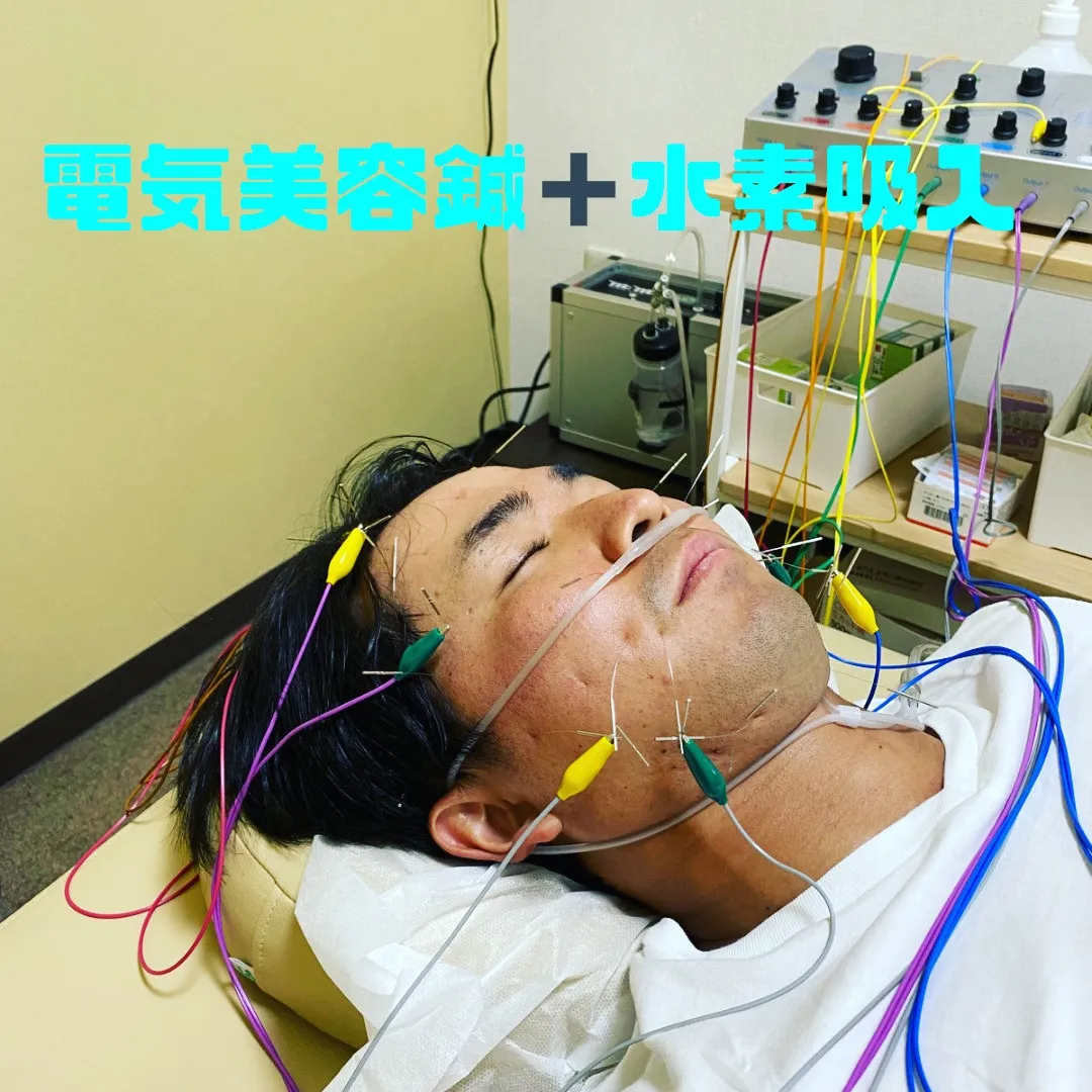 ◆ 美容鍼の主な効果